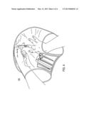 NAIL CLIPPING AND CATCHMENT APPARATUS diagram and image