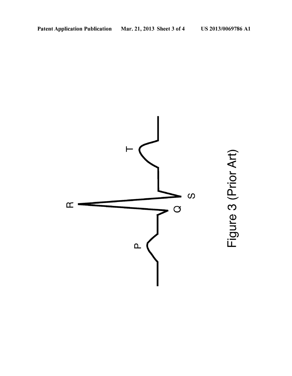 DETECTING REGIME CHANGE IN STREAMING DATA - diagram, schematic, and image 04