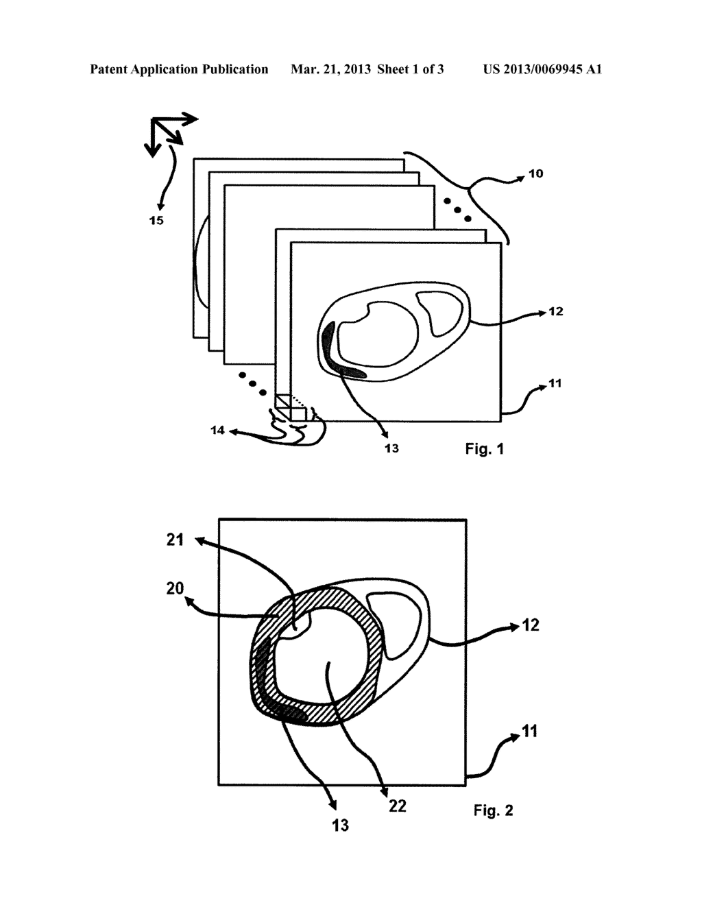 METHOD FOR DISPLAYING THE INFORMATION CONTAINED IN THREE-DIMENSIONAL     IMAGES OF THE HEART - diagram, schematic, and image 02