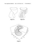 PARTICAL IMAGE VELOCIMETRY SUITABLE FOR X-RAY PROJECTION IMAGING diagram and image