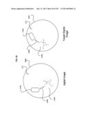 Coregistering images of a region of interest during several conditions     using a landmark subsurface feature diagram and image