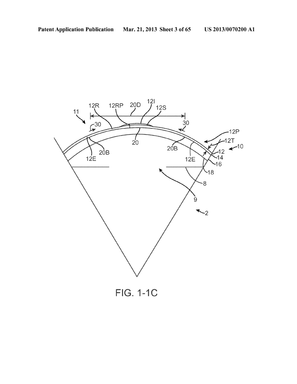 Conformable Therapeutic Shield for Vision and Pain - diagram, schematic, and image 04