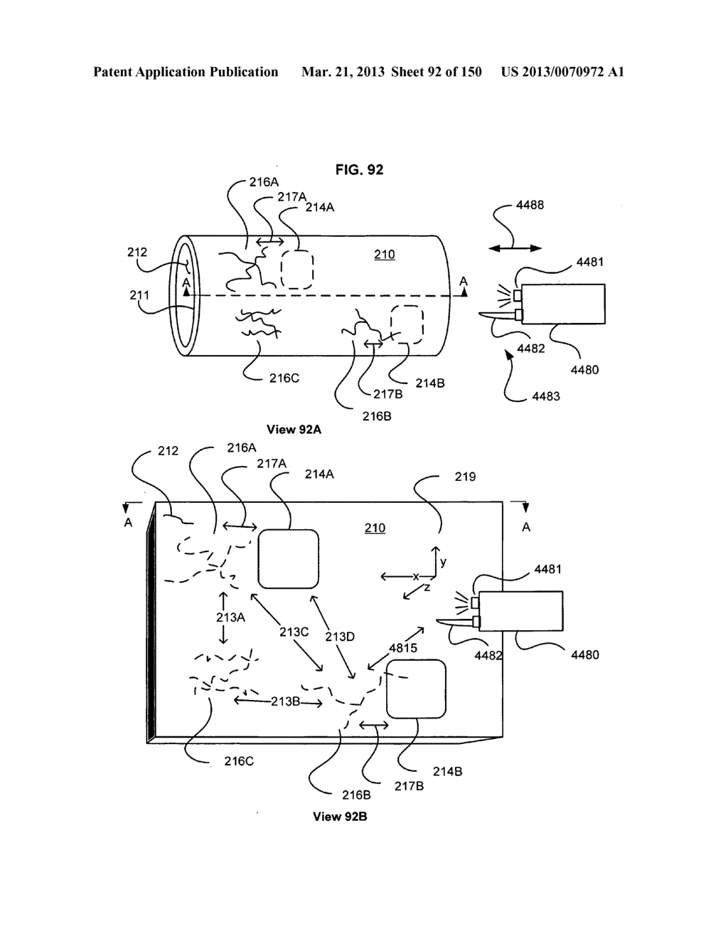 Patient verification based on a landmark subsurface feature of the     patient's body part - diagram, schematic, and image 93