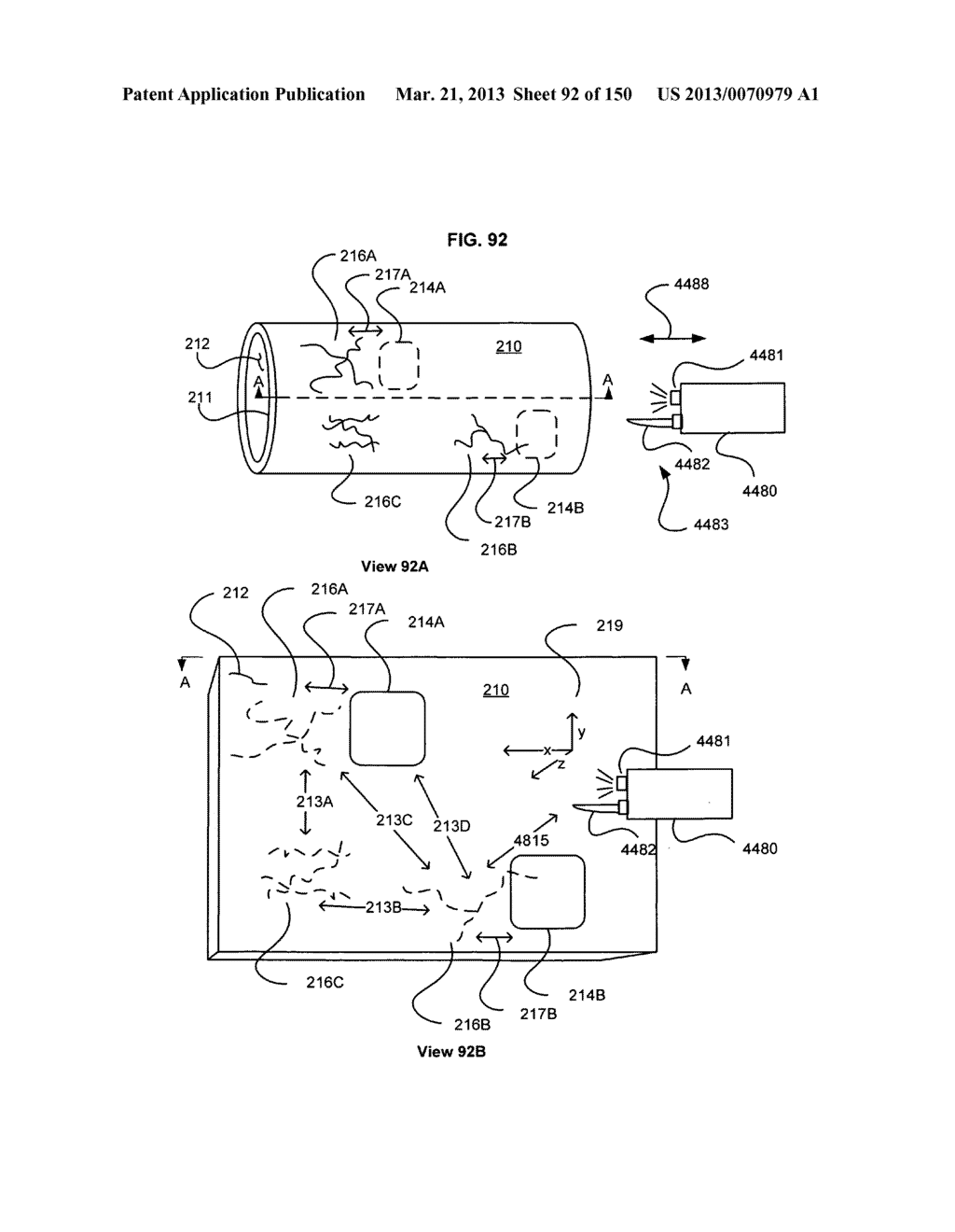 Registering regions of interest of a body part to a coordinate system - diagram, schematic, and image 93