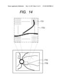 FUNDUS IMAGE ACQUIRING APPARATUS AND CONTROL METHOD THEREFOR diagram and image