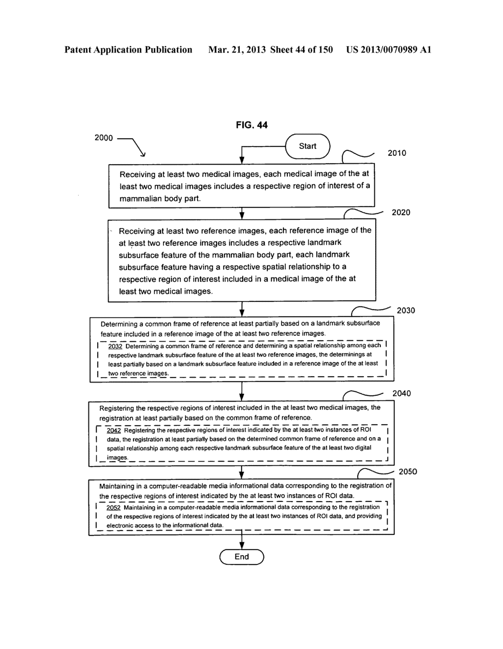 Registering a region of interest of a body part to a landmark subsurface     feature of the body part - diagram, schematic, and image 45