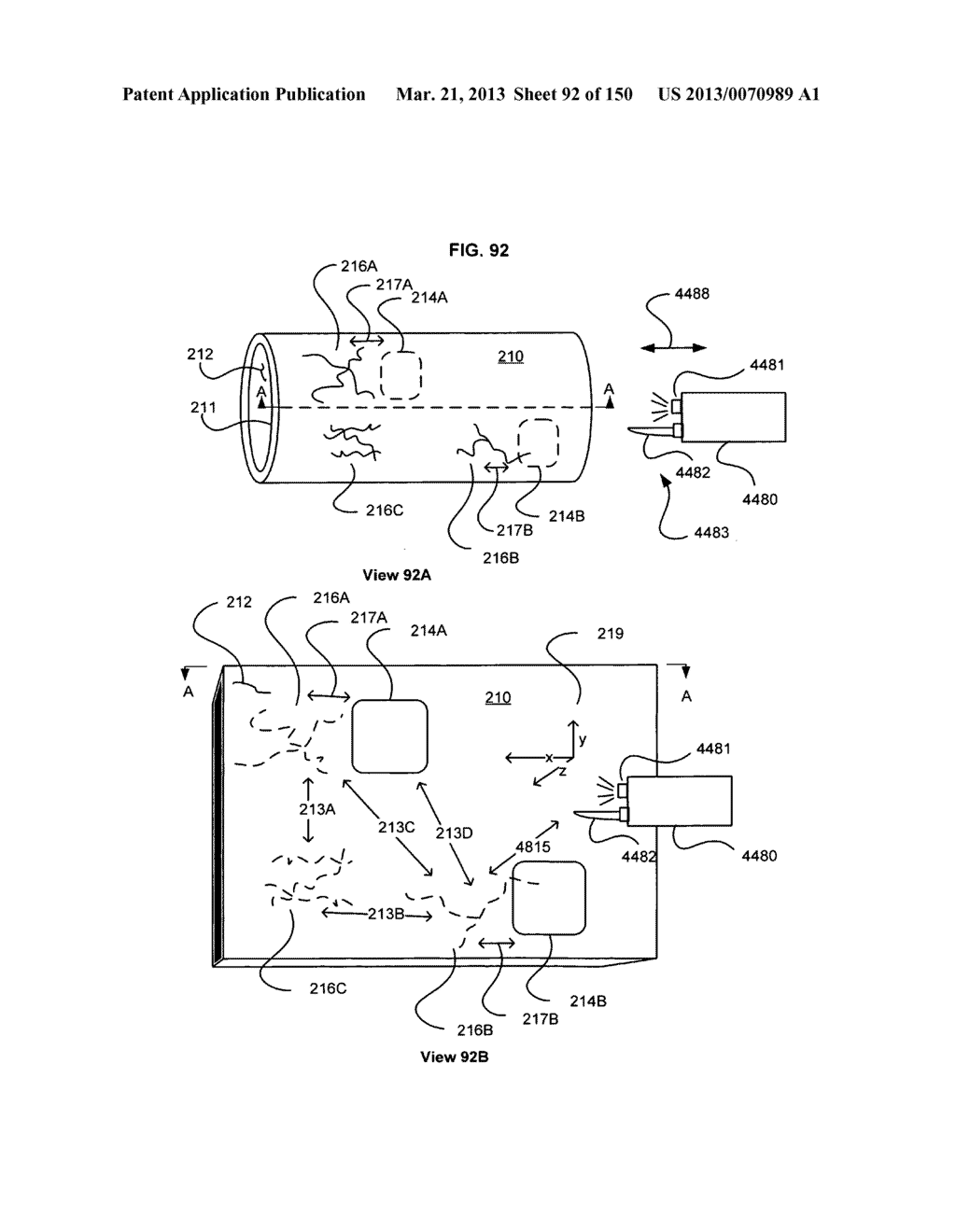 Registering a region of interest of a body part to a landmark subsurface     feature of the body part - diagram, schematic, and image 93