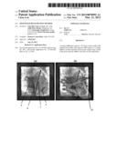 2D/3D IMAGE REGISTRATION METHOD diagram and image