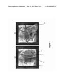 2D/3D IMAGE REGISTRATION METHOD diagram and image