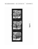 2D/3D IMAGE REGISTRATION METHOD diagram and image