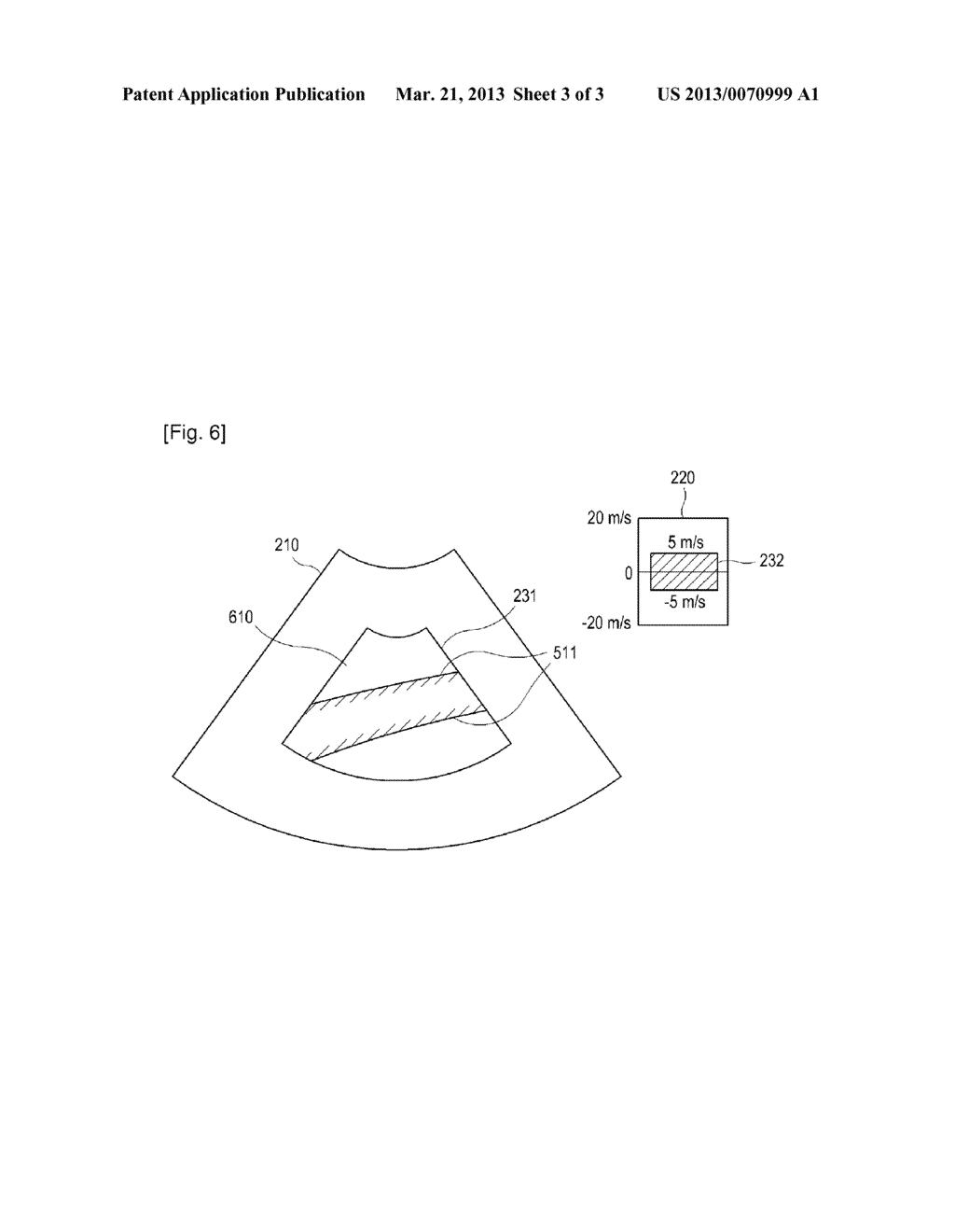 ULTRASOUND SYSTEM AND METHOD FOR PROVIDING COLOR RECONSTRUCTION IMAGE - diagram, schematic, and image 04