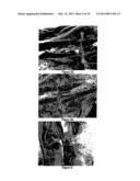 METHODS AND COMPOSITIONS FOR BONE AND CARTILAGE REPAIR diagram and image