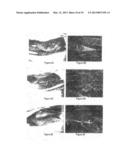 METHODS AND COMPOSITIONS FOR BONE AND CARTILAGE REPAIR diagram and image