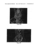 METHODS AND COMPOSITIONS FOR BONE AND CARTILAGE REPAIR diagram and image