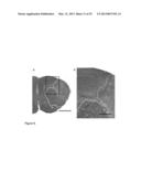 Small Heat Shock Proteins and Active Fragments Thereof as a Therapy for     Inflammation and Ischemia diagram and image