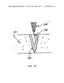 TRANSLUMINAL DRUG DELIVERY METHODS AND DEVICES diagram and image