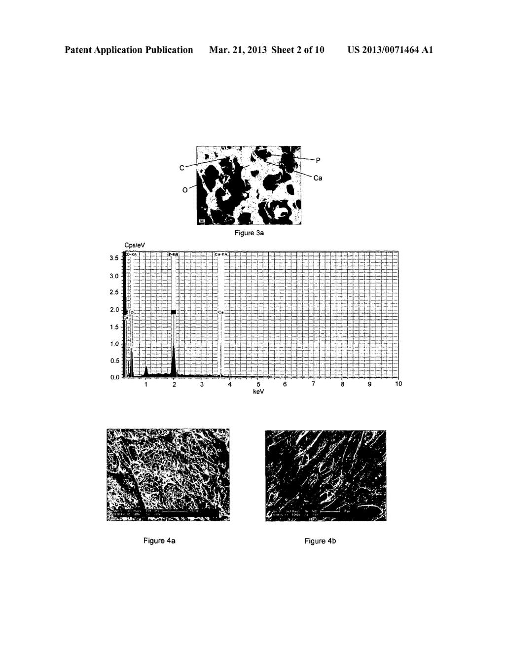 COMPOSITION COMPRISING PHOSPHONIC ACID POLYMER FOR USE AS TISSUE     ENGINEERING FIBROUS SCAFFOLD - diagram, schematic, and image 03