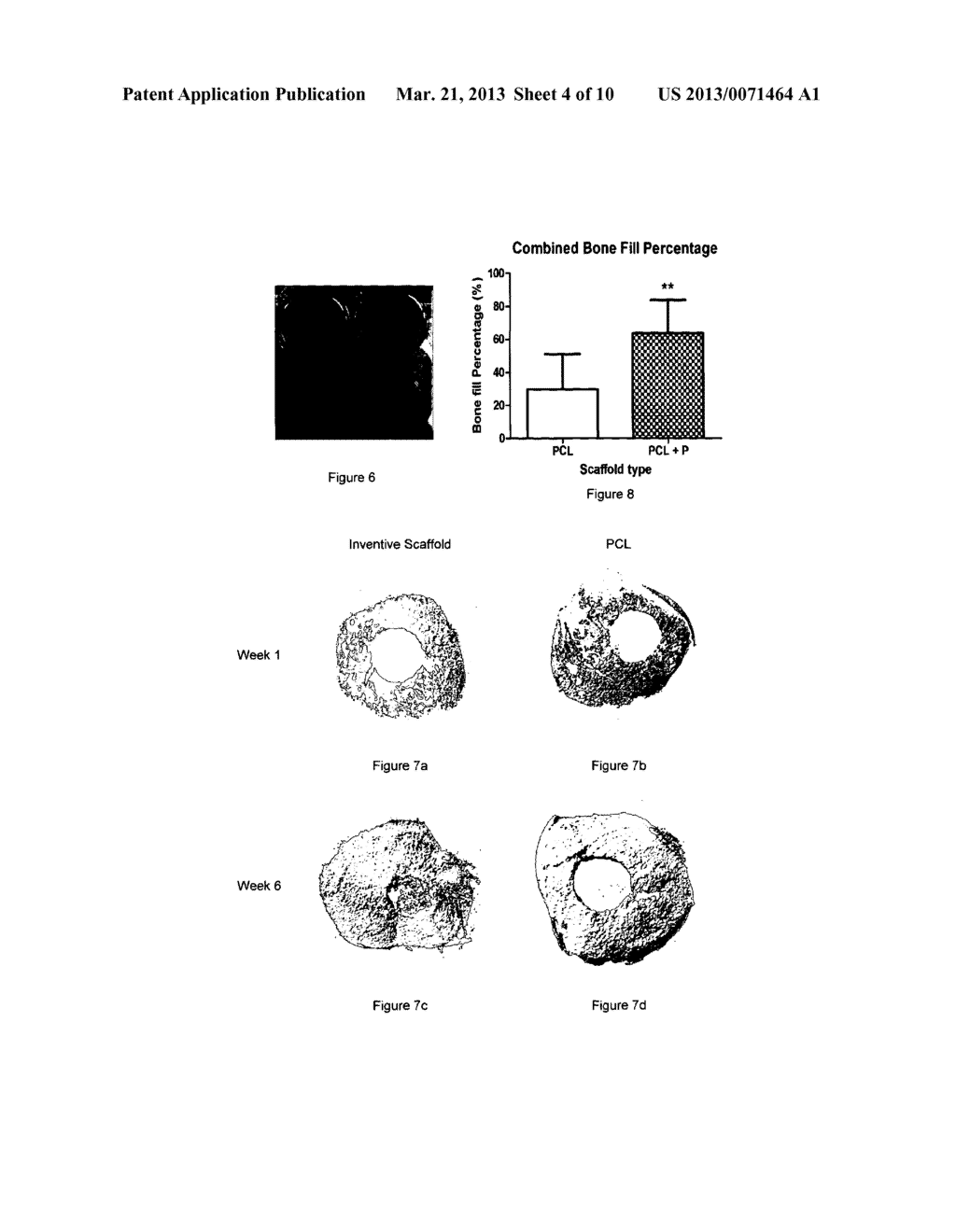 COMPOSITION COMPRISING PHOSPHONIC ACID POLYMER FOR USE AS TISSUE     ENGINEERING FIBROUS SCAFFOLD - diagram, schematic, and image 05