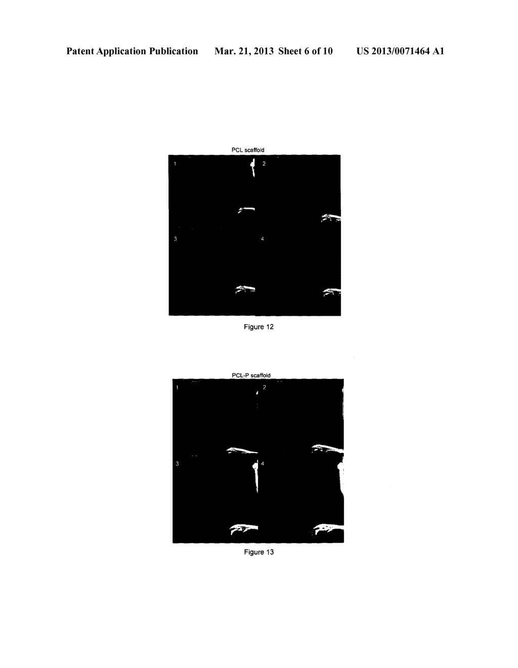 COMPOSITION COMPRISING PHOSPHONIC ACID POLYMER FOR USE AS TISSUE     ENGINEERING FIBROUS SCAFFOLD - diagram, schematic, and image 07