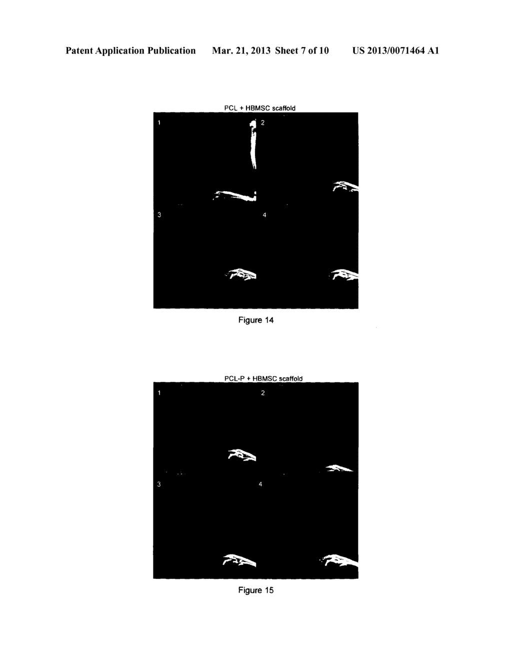 COMPOSITION COMPRISING PHOSPHONIC ACID POLYMER FOR USE AS TISSUE     ENGINEERING FIBROUS SCAFFOLD - diagram, schematic, and image 08