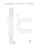 Self-Sealing PTFE Graft with Kink Resistance diagram and image