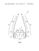 APPLYING CORRECTIVE FORCES WITHIN THE PALATE diagram and image