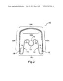 APPLYING CORRECTIVE FORCES WITHIN THE PALATE diagram and image