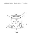 APPLYING CORRECTIVE FORCES WITHIN THE PALATE diagram and image