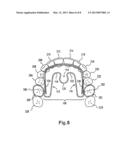 APPLYING CORRECTIVE FORCES WITHIN THE PALATE diagram and image