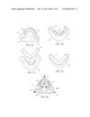 EDENTULOUS SURGICAL GUIDE diagram and image