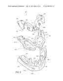 EDENTULOUS SURGICAL GUIDE diagram and image