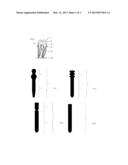 Dental Posts diagram and image