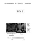 COLON CANCER BIOMARKER DISCOVERY diagram and image