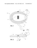 DIRECT CONTACT RACQUET diagram and image