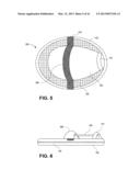 DIRECT CONTACT RACQUET diagram and image