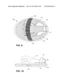 DIRECT CONTACT RACQUET diagram and image