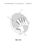 DIRECT CONTACT RACQUET diagram and image