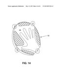 DIRECT CONTACT RACQUET diagram and image