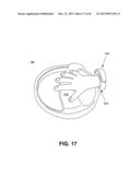 DIRECT CONTACT RACQUET diagram and image