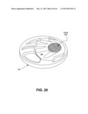 DIRECT CONTACT RACQUET diagram and image