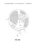 DIRECT CONTACT RACQUET diagram and image