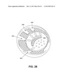 DIRECT CONTACT RACQUET diagram and image