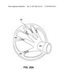 DIRECT CONTACT RACQUET diagram and image