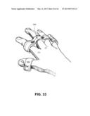 DIRECT CONTACT RACQUET diagram and image