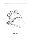 DIRECT CONTACT RACQUET diagram and image