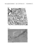 Protease Inhibitors and Preventives or Remedies for Disease diagram and image