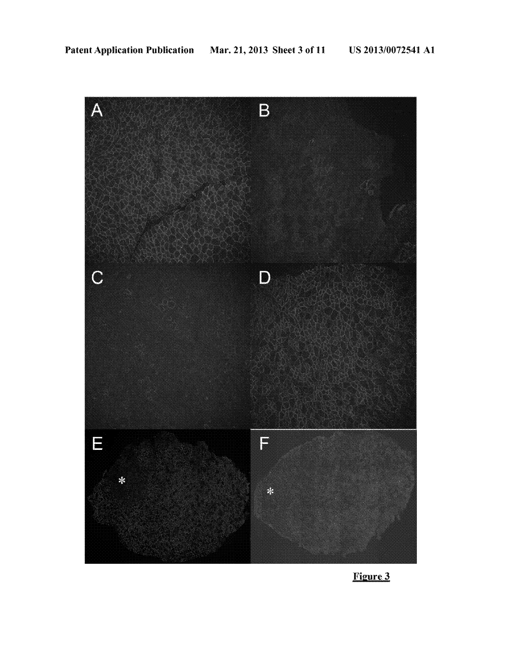 ADENO-ASSOCIATED VIRAL VECTOR FOR EXON SKIPPING IN A GENE ENCODING A     DISPENSIBLE-DOMAIN PROTEIN - diagram, schematic, and image 04