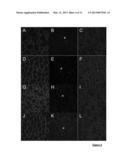 ADENO-ASSOCIATED VIRAL VECTOR FOR EXON SKIPPING IN A GENE ENCODING A     DISPENSIBLE-DOMAIN PROTEIN diagram and image