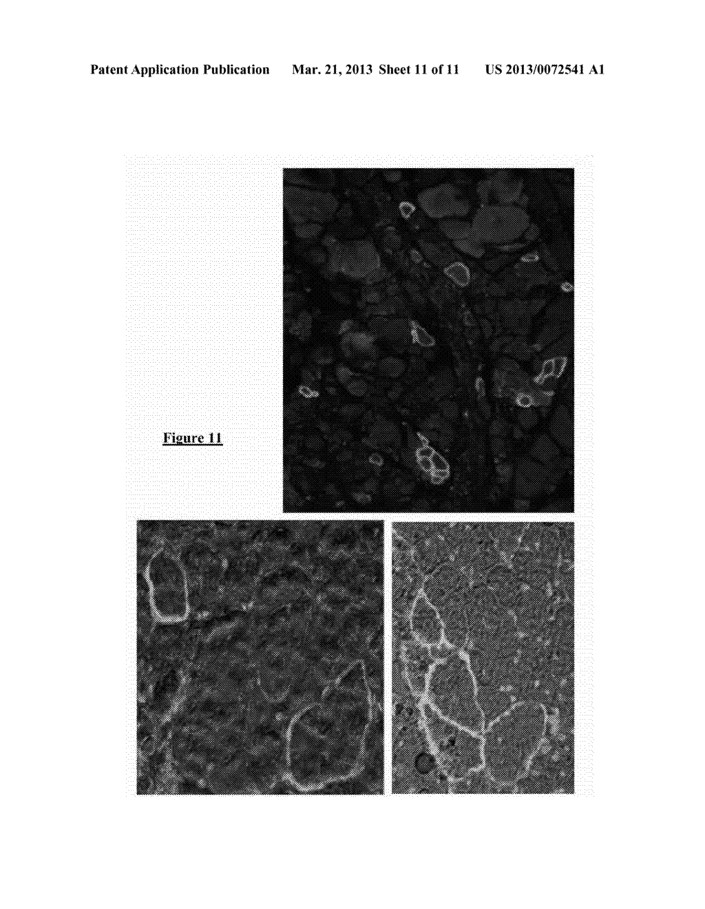 ADENO-ASSOCIATED VIRAL VECTOR FOR EXON SKIPPING IN A GENE ENCODING A     DISPENSIBLE-DOMAIN PROTEIN - diagram, schematic, and image 12