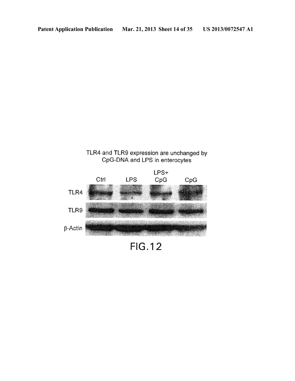 USE OF TOLL-LIKE RECEPTOR-9 AGONISTS, TOLL-LIKE RECEPTOR-4 ANTAGONISTS,     AND/OR NUCLEAR OLIGOMERIZATION DOMAIN-2 AGONISTS FOR THE TREATMENT OF     PREVENTION OF TOLL-LIKE RECEPTOR-4-ASSOCIATED DISORDERS - diagram, schematic, and image 15